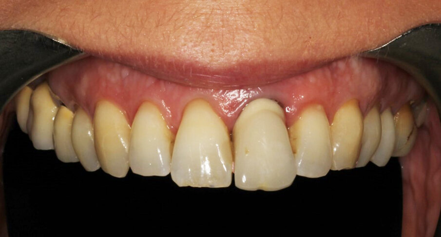 Fig. 7