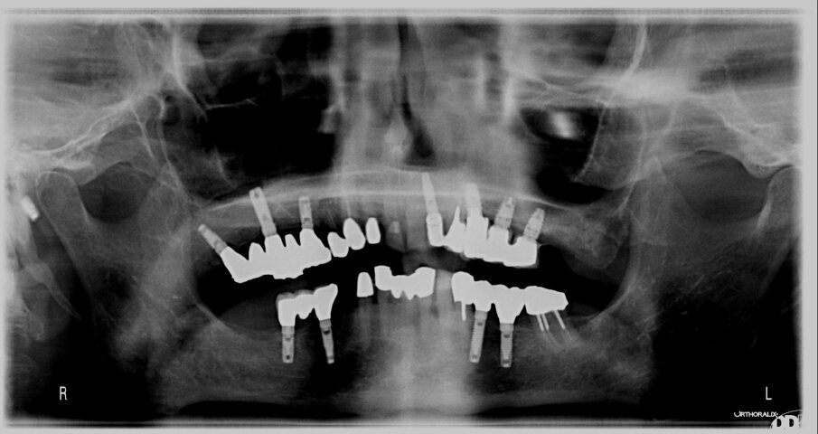 Fig. 5b