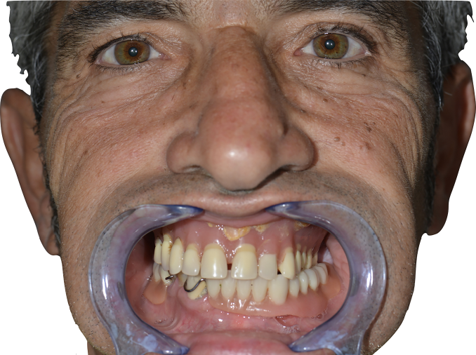 Fig. 3