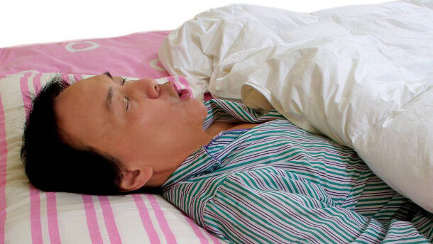 Bénéfices de l'orthèse d'avancée mandibulaire dans le traitement des apnées obstructives du sommeil