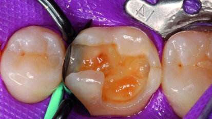 Forme et couleur – facteurs également dans les matrices sectorielles ?