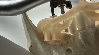 Guided surgery