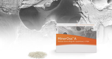 Camlog adds allogeneic products to its biomaterials portfolio