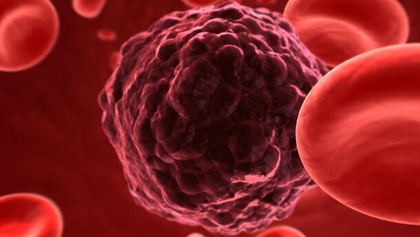 La Journée mondiale de lutte contre le cancer sous le signe de l'espoir