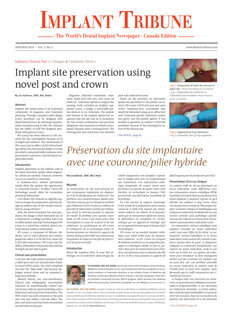 Implant Tribune Canada No. 3, 2014