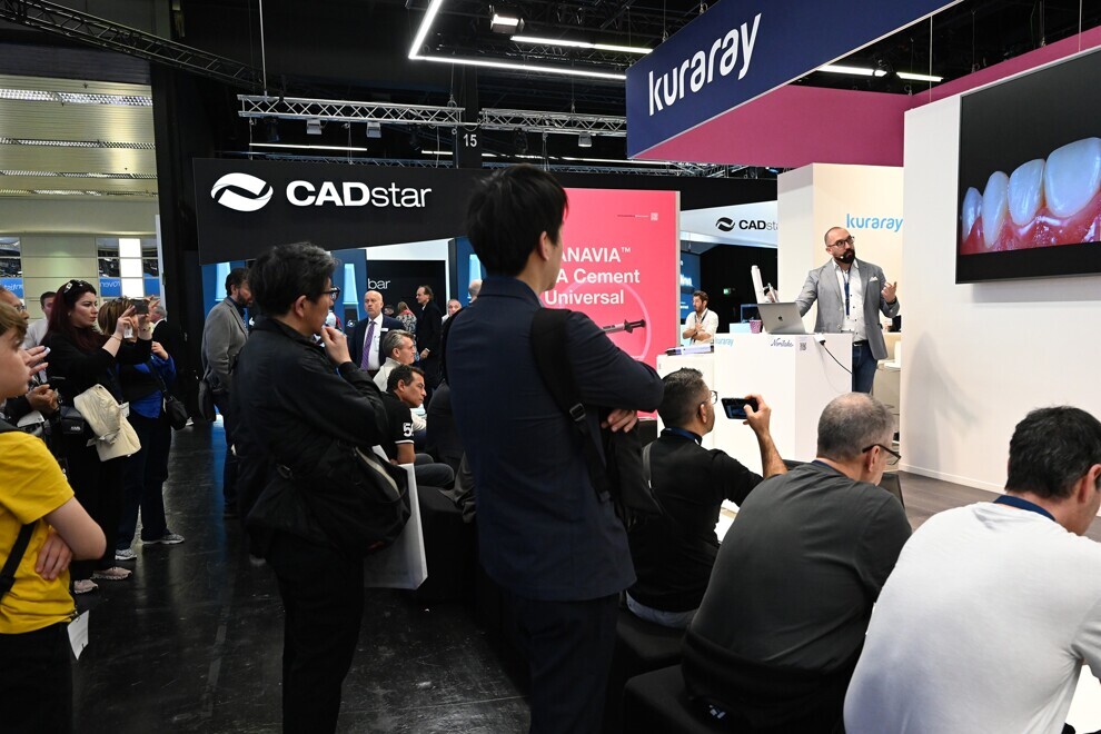 During the International Dental Show, the well-known speaker Dr Enzo Attanasio lectured on three topics, including the flowable injection technique and BEST.FIT, a hybrid technique for efficient and aesthetic restoration of anterior teeth.