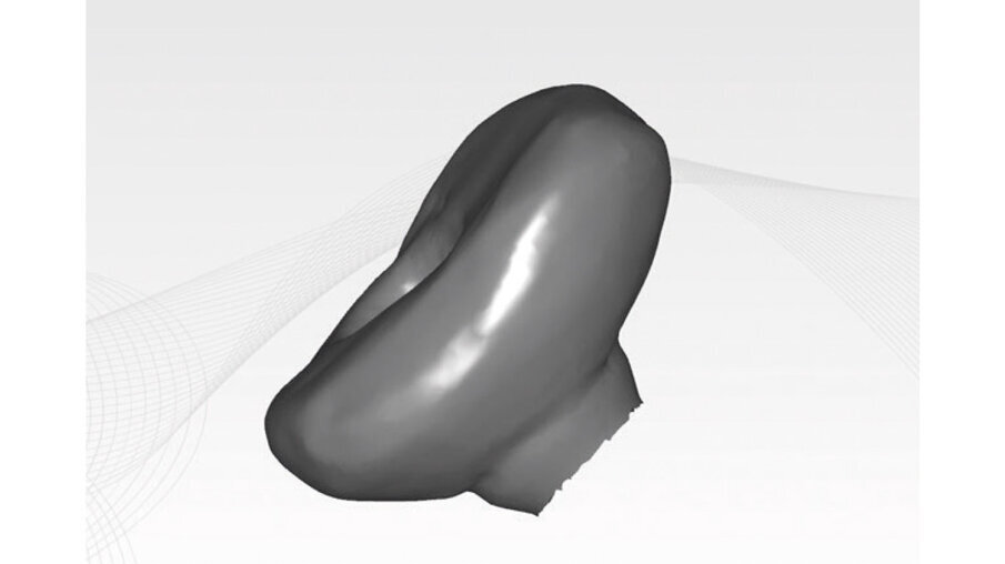 Figg. 8a-8c - Progettazione CAD della vite di guarigione customizzata.