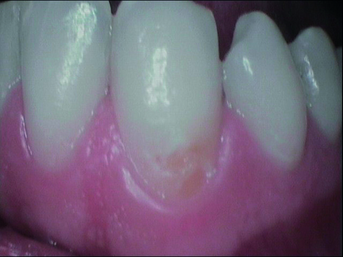 Fig. 2a