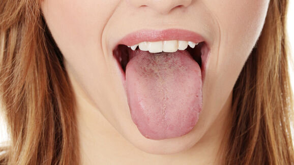 Trained nose can detect oral disease on bad breath