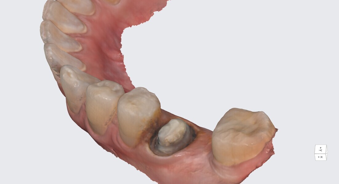 Fig. 17