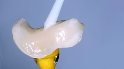 Silane coupling agents and surface conditioning in dentistry