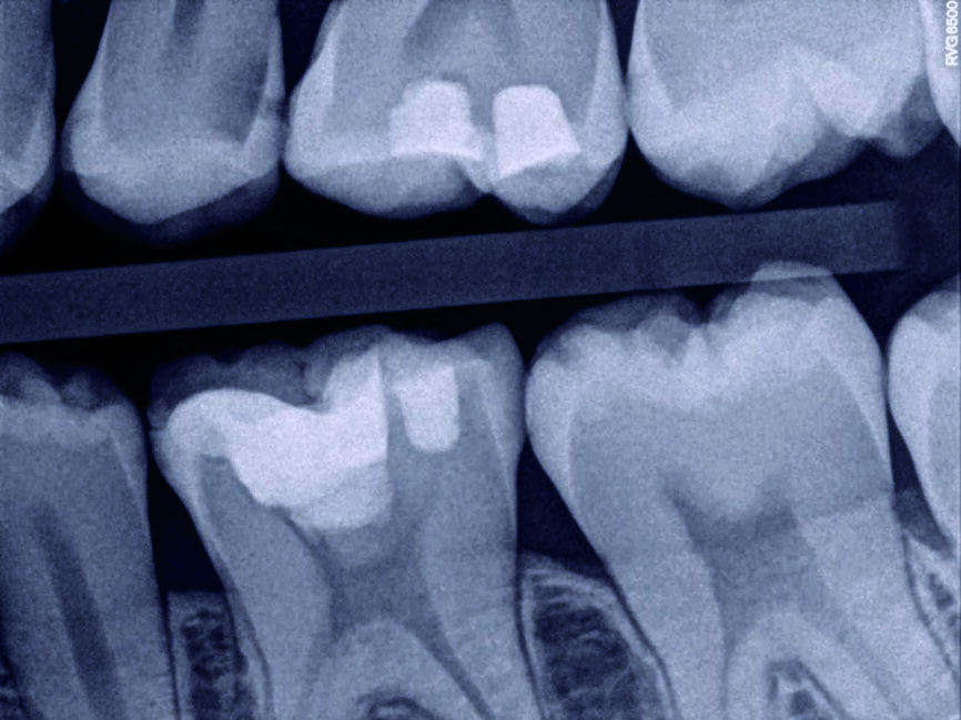 Fig. 9