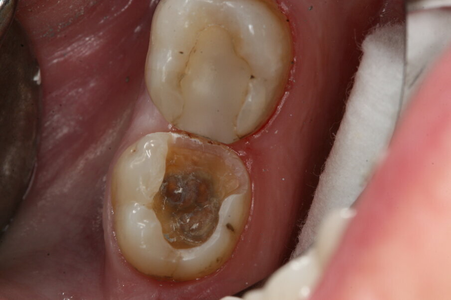 Fig. 6