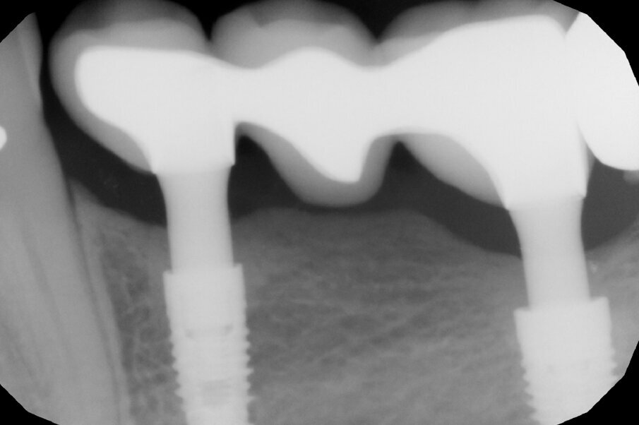 Fig. 6a