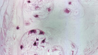 Nasce BioCell Collagen II, la sostanza innovativa per combattere l’ATM