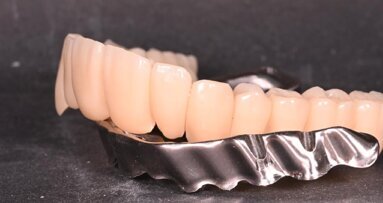 OT Bridge: protesi fisse complesse ma possibili con CEPROSEM e CIMsystem