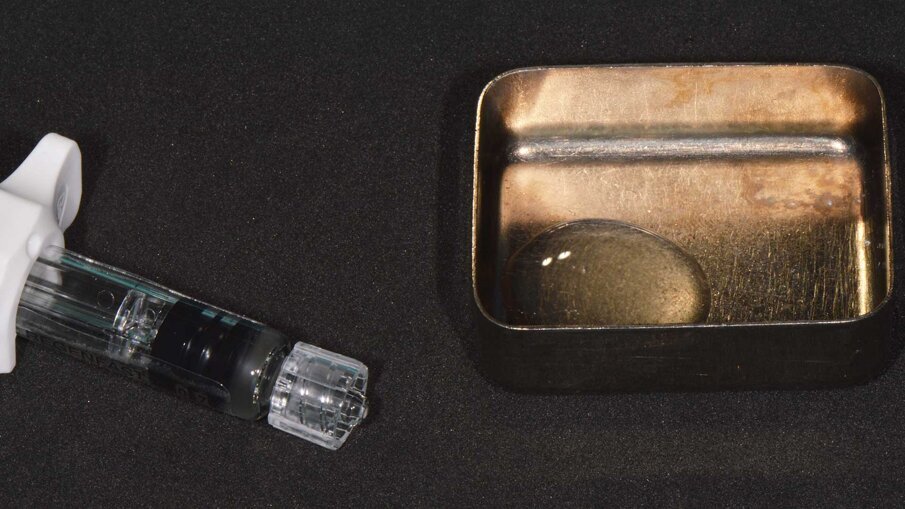 Fig. 4 - Il gel REGENFAST è dosato e posizionato direttamente all’interno del difetto perimplantare mediante spatolina o puntale.