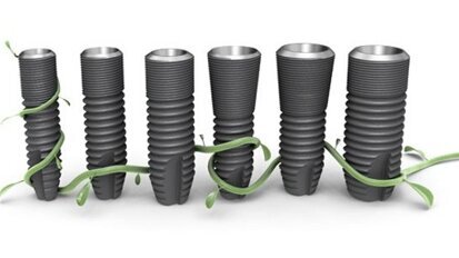 Astra Tech's latest implant system available in the US