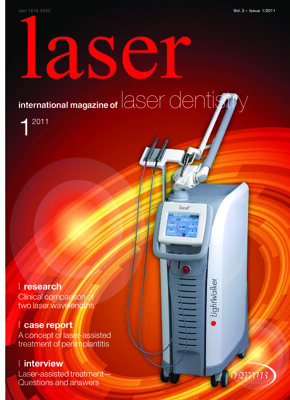 laser international No. 1, 2011