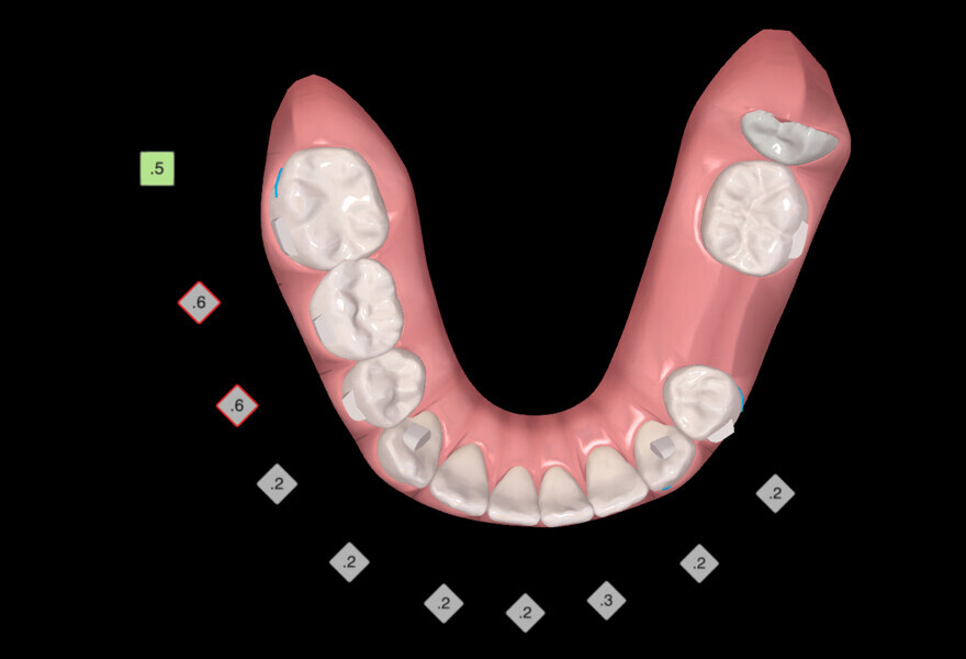 Fig. 19