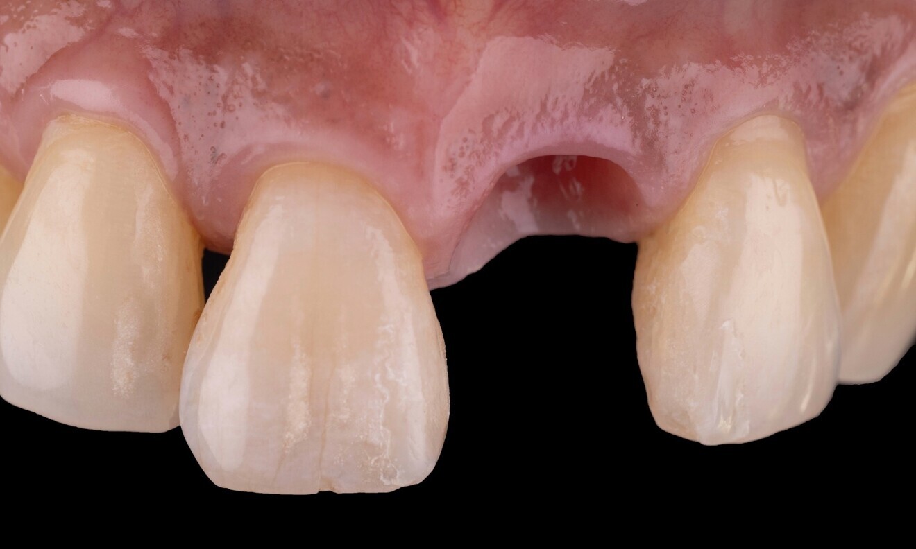 Fig. 14
