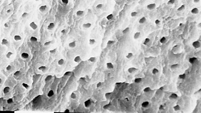 Il punto sull’irrigazione in endodonzia (seconda parte)