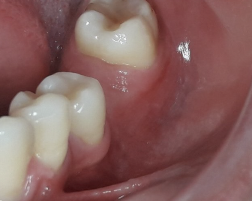 Fig. 2a