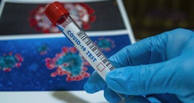 ICMR replies to dentist's letter on the use of Rapid Antigen Tests for Covid-19 in dental clinics
