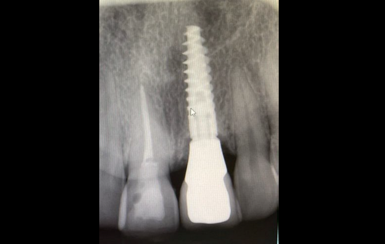 Radiograph (g) ...