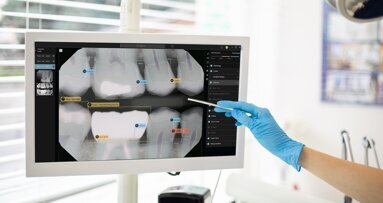 FDA-ino odobrenje označava veliki korak za softver Second Opinion