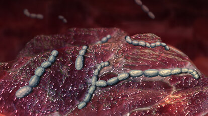 Dual-light photodynamic therapy helps kill oral bacteria