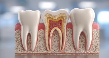 Porosität im Dentin korreliert mit erhöhter Zinkkonzentration