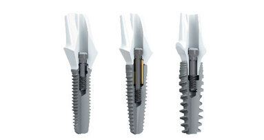 Nobel Biocare annuncia collaborazione con 3Shape
