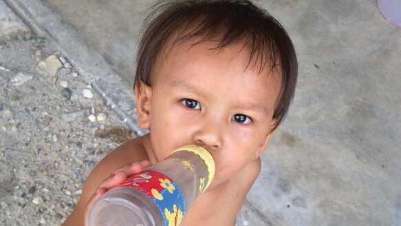 Caries accounts for one-third of day surgeries for preschoolers