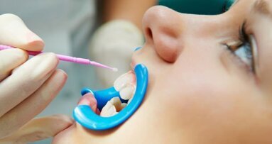 Превенция на зъбния кариес: дентални силанти или флуорни лакове?