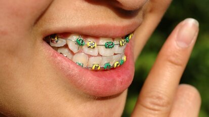 Orthodontisten schroeven tarieven op