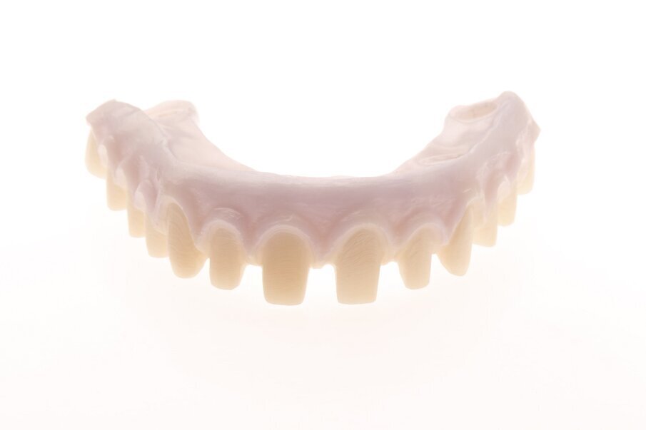 Fig. 6b: Single-crown design on different framework materials for easy repair.