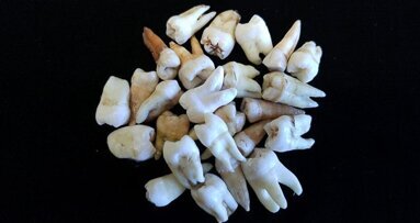 História da deficiência em vitamina D escondida embaixo do esmalte