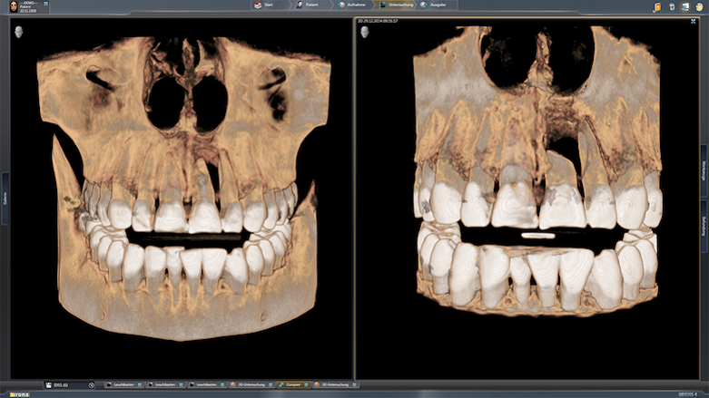 Sidexis 4: More than just imaging software