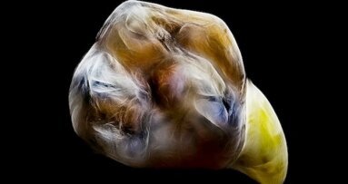 Artistik Dental Fotoğraflar IDS 2017’ye Gidiyor