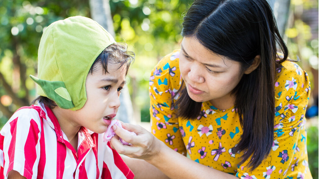 Young children face greatest risk of sequelae from primary tooth luxation