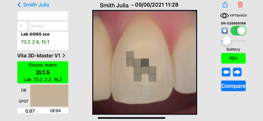 Fig. 15: Desired shade (neighbouring tooth).