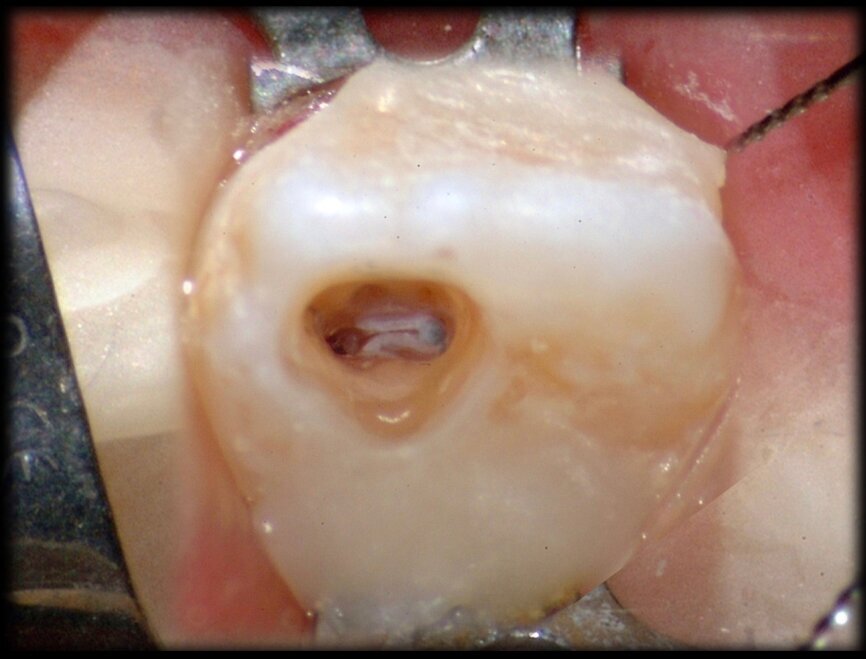 Fig. 34