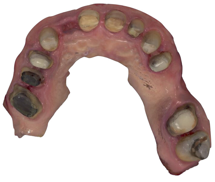 Fig. 11