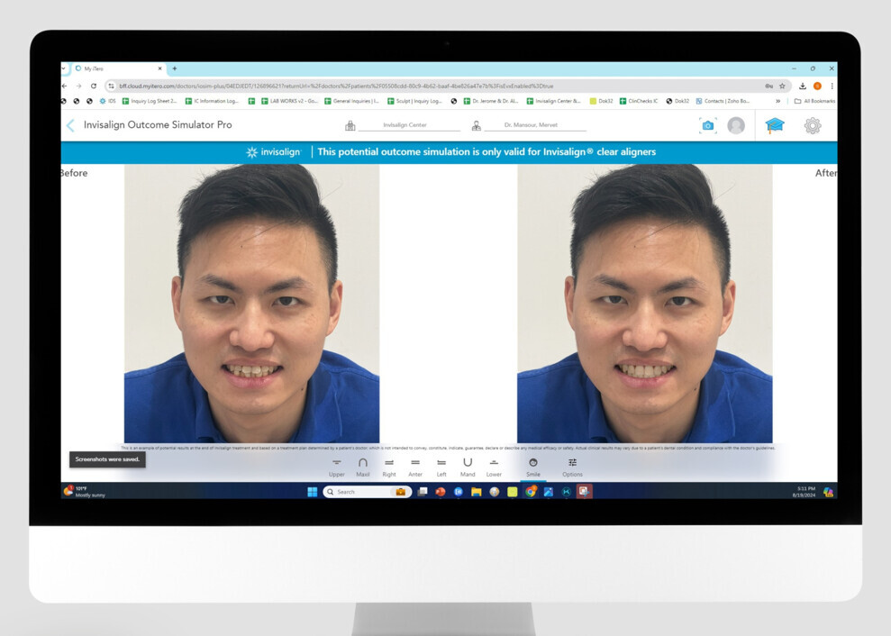 Virtual visualisation tools, such as orthodontic virtual setups, show clinically acceptable accuracy in simulating treatment outcomes and should be integrated into orthodontic practice and education.