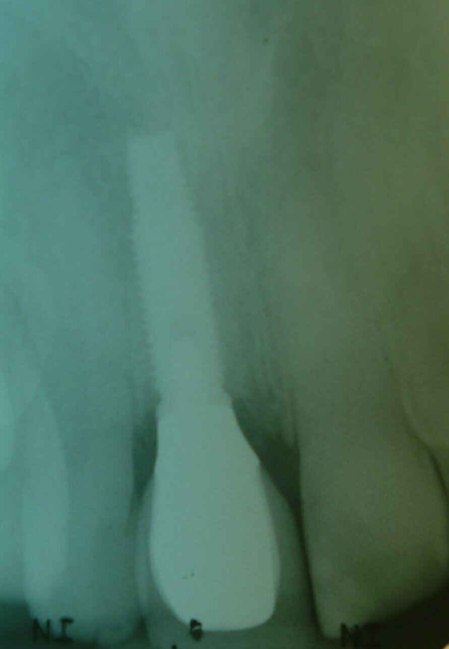 Fig. 21