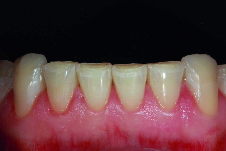Fig.22