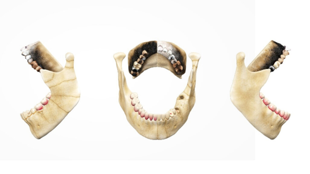 Forensic odontology education: The interactive capability of 3D models facilitates deeper comprehension
