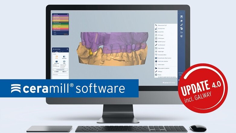 Amann Girrbach optimiert die gesamte Ceramill Software-Familie