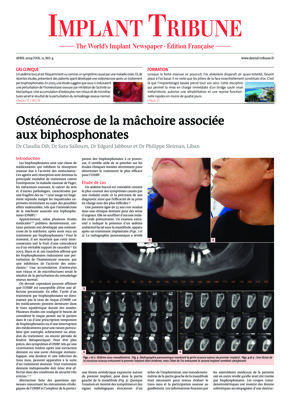 Implant Tribune France No. 2, 2019